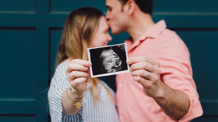 a couple show their baby ultrasound picture